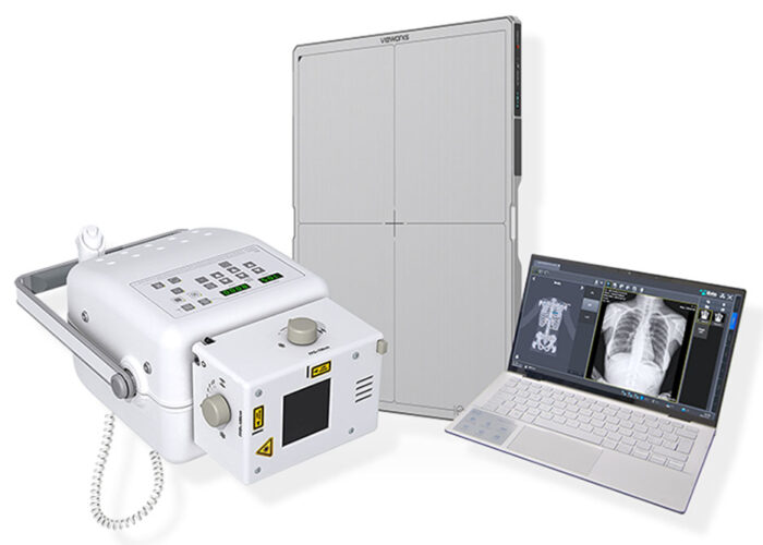 HOME-RAY-NEW sistema radiologico portatile per esami a domicilio